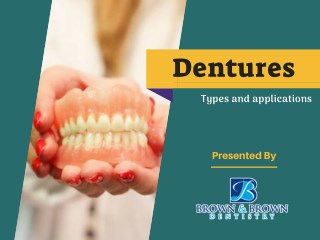 Facts on Partial and Full Dentures