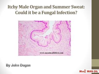 Itchy Male Organ and Summer Sweat: Could it be a Fungal Infection?