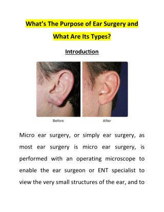 Whatâ€™s The Purpose of Ear Surgery and What Are Its Types?