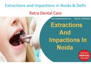 Extractions and Impactions in Noida & Delhi