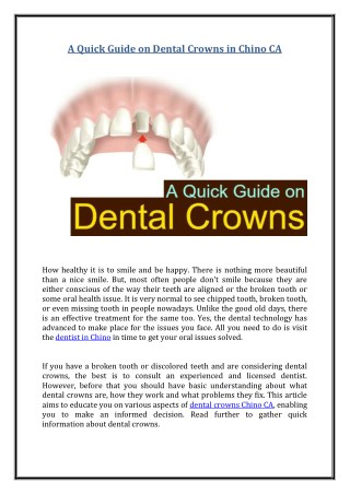 A Quick Guide on Dental Crowns in Chino CA