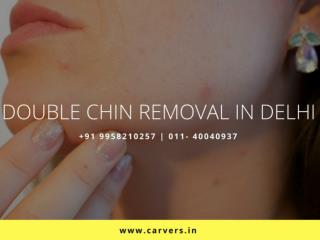 Double Chin Removal in Delhi