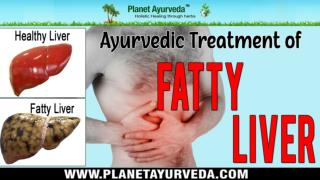 Herbal Remedies for Fatty Liver, Ayurvedic Treatment