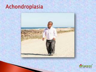 Achondroplasia
