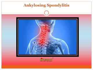 Ankylosing Spondylitis