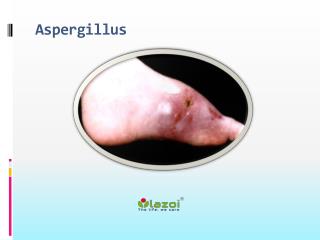 Aspergillus
