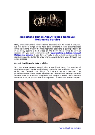 Important Things About Tattoo Removal Melbourne Service