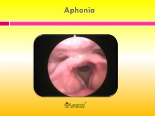 Aphonia