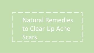 Natural Remedies to Clear Up Acne Scars