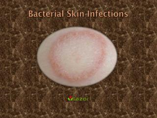 Bacterial Skin Infections : Causes, Symptoms, Treatment and Diagnosis