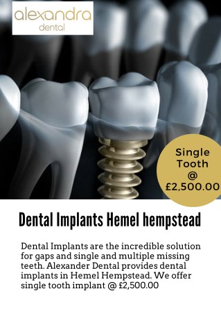 Dental Implants Hemel hempstead