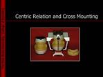 Centric Relation and Cross Mounting