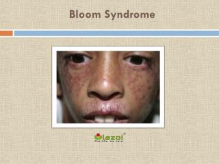 Bloom Syndrome