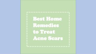 Best Home Remedies to Treat Acne Scars