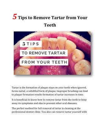 5 Tips to Remove Tartar from Your Teeth