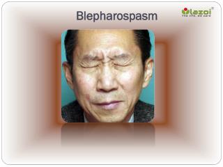 Blepharospasm