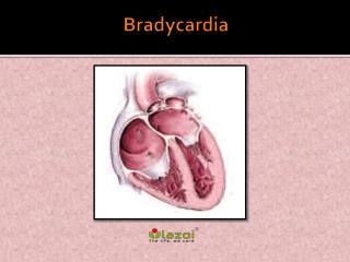 Bradycardia