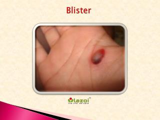 Blister