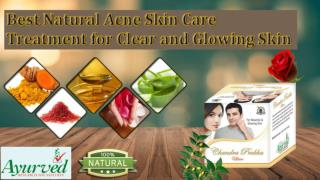 Best Natural Acne Skin Care Treatment for Clear and Glowing Skin