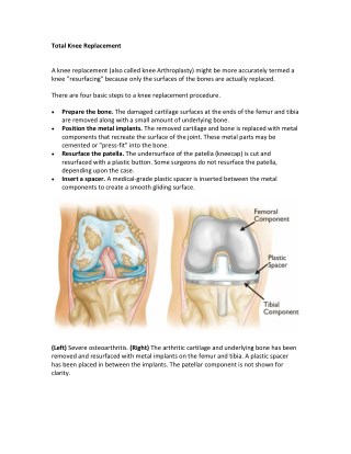 Total Knee Joint Replacement Surgery|Best Knee Surgeon|Orthopedic Hospital Guntur|Vijayawada|Prakasam|AP|India