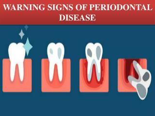 WARNING SIGNS OF PERIODONTAL DISEASE