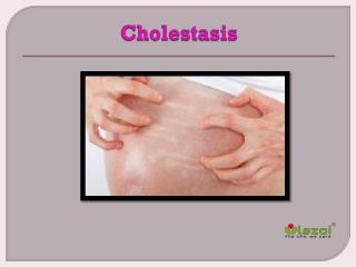 Cholestasis