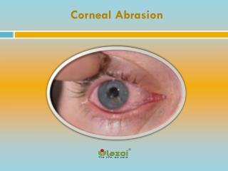 Corneal Abrasion