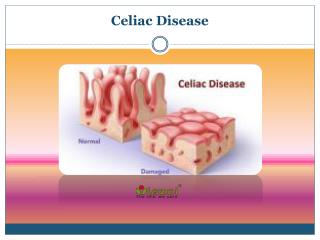 Celiac Disease