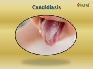 Candidiasis