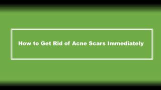 How to Get Rid of Acne Scars Immediately