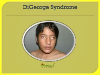 DiGeorge Syndrome