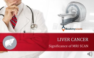 The need for an MRI scan in Liver cancer detection