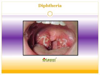 Diphtheria