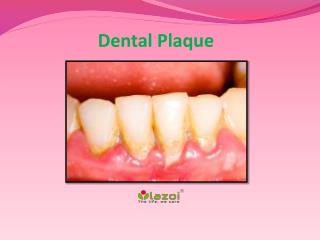 Dental Plaque