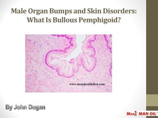 Male Organ Bumps and Skin Disorders: What Is Bullous Pemphigoid?