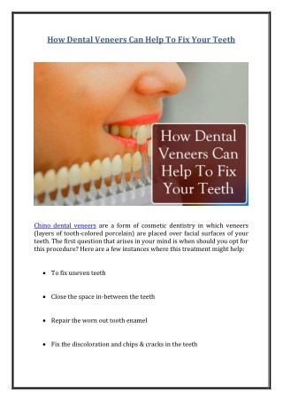 How Dental Veneers Can Help To Fix Your Teeth