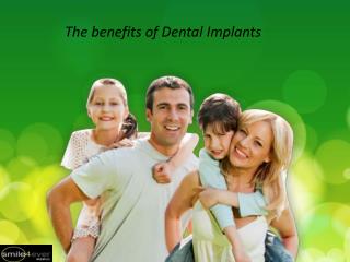 The benefits of Dental Implants