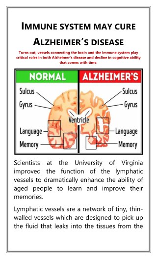 Immune System May Cure Alzheimerâ€™s Disease