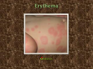 Erythema