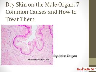 Dry Skin on the Male Organ: 7 Common Causes and How to Treat Them