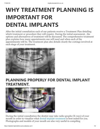 WHY TREATMENT PLANNING IS IMPORTANT FOR DENTAL IMPLANTS