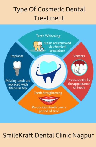 Type of cosmetic Dental Treatment