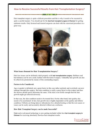 How to Receive Successful Results from Hair Transplantation Surgery?