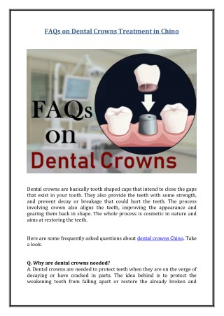 FAQs on Dental Crowns Treatment in Chino