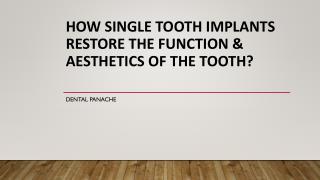 How Single Tooth Implants Restore The Function & Aesthetics of The Tooth?