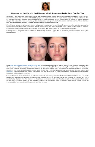 Melasma on the Face? - Deciding On which Treatment is the Best One for You