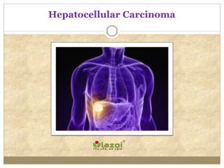 Hepatocellular Carcinoma: Causes, Symptoms, Daignosis, Prevention and Treatment