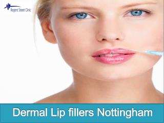 Dermal Lip fillers Nottingham