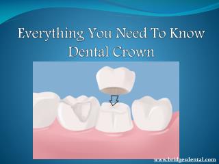 Brandon Dentist: Everything Need To Know About Various Kinds of Dental Crown| Bridges Dental