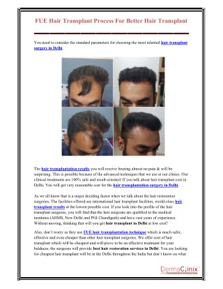 FUE Hair Transplant Process For Better Hair Transplant